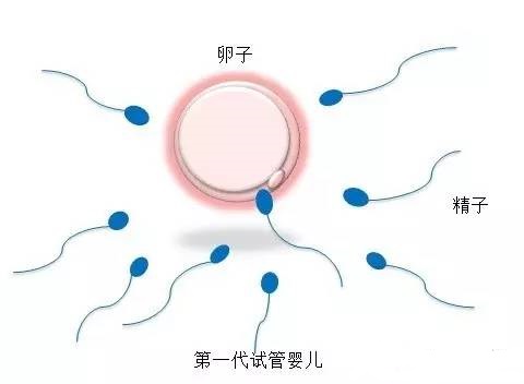 人工高龄供卵代怀微信群